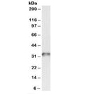 Western blot testing of human platelet lysate with TPM4 antibody at 0.03ug/ml. Predicted molecular weight: ~33kDa.