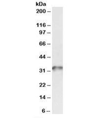 Western blot testing of human platelet lysate with TPM4 antibody at 0.03ug/ml. Predicted molecular weight: ~33kDa.