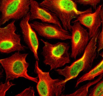 Immunofluorescent staining of SIPA1 using anti-SIPA1 antibody (green) and anti-Beta Tubulin antibody (red). SIPA1 was detected in an immunocytochemical section of U2OS cells. Enzyme antigen retrieval was performed using IHC enzyme antigen retrieval reagent for 15 mins. The cells were blocked with 10% goat serum. And then incubated with 5 ug/ml rabbit anti-SIPA1 antibody and mouse anti-Beta Tubulin antibody overnight at 4oC.