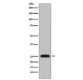Western blot testing of human plasma lysate with Lambda light chain antibody. Predicted molecular weight: 22-25 kDa.