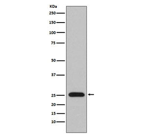 Western blot testing of human plasma lysate with Lambda light chain antibody. Predicted molecular weight: 22-25 kDa.