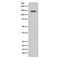 Western blot testing of human SH-SY5Y cell lysate with FGFR1 antibody. Expected molecular weight: 75-160 kDa depending on glycosylation level.