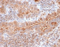 IHC staining of FFPE human thyroid with Calcitonin antibody (clone CALCA/3310). HIER: boil tissue sections in pH 9 10mM Tris with 1mM EDTA for 20 min and allow to cool before testing.