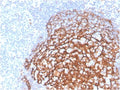IHC staining of FFPE human tonsil tissue with recombinant CD21 antibody (clone CR2/3990R). HIER: boil tissue sections in pH 9 10mM Tris with 1mM EDTA for 20 min and allow to cool before testing.
