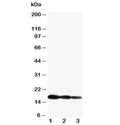 Western blot testing of IL1 beta antibody and Lane 1: Recombinant mouse IL1b partial protein 10ng; 2: 5ng; 3: 2.5ng