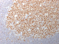 IHC testing of FFPE human tonsil tissue with Bcl6 antibody (clone BCL6/1982). Required HIER: boil tissue sections in 10mM Tris with 1mM EDTA, pH 9, for 10-20 min.