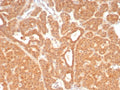 IHC staining of FFPE human parathyroid tissue with c-RET antibody (clone RET/8789). HIER: boil tissue sections in pH 9 10mM Tris with 1mM EDTA for 20 min and allow to cool before testing.