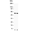 Western blot testing of GLUT4 antibody and Lane 1: rat heart; 2: rat skeletal muscle. Predicted molecular weight: 45-55kDa.
