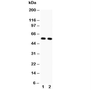 Western blot testing of GLUT4 antibody and Lane 1: rat heart; 2: rat skeletal muscle. Predicted molecular weight: 45-55kDa.
