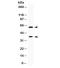 Western blot testing of human HeLa cell lysate with TPP1 antibody. Expected molecular weight: 61/34 kDa (isoforms 1/2).