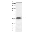 Western blot testing of human A375 cell lysate with CTSB antibody. Molecular weight: 38-46 kDa depending on glycosylation level. An ~31 kDa form (propeptide removed) may be observed and may be further processed into an ~25 kDa heavy chain and ~5 kDa light chain.
