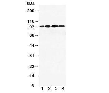 Western blot testing of Mineralocorticoid Receptor antibody and Lane 1: 293T; 2: SMMC-7721; 3: SW620; 4: HeLa cell lysate. Expected molecular weight ~107/108/94 kDa (isoforms 1/3/4).