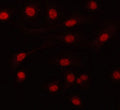 Immunofluorescent staining of FFPE human A549 cells with PRPF6 antibody. HIER: steam section in pH6 citrate buffer for 20 min.