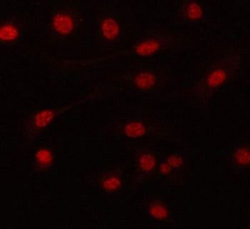 Immunofluorescent staining of FFPE human A549 cells with PRPF6 antibody. HIER: steam section in pH6 citrate buffer for 20 min.
