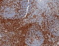 IHC staining of FFPE human tonsil tissue with CD45RA antibody (clone PTPRC/8124R). HIER: boil tissue sections in pH 9 10mM Tris with 1mM EDTA for 20 min and allow to cool before testing.