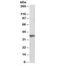 Western blot testing of Jurkat lysate with AIMP1 antibody at 0.3ug/ml. Predicted molecular weight: ~34/37kDa (isoforms 1/2).