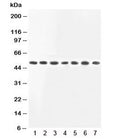 Western blot testing of MEK2 antibody and Lane 1: rat skeletal muscle; 2: rat kidney; and human samples 3: HeLa; 4: COLO320; 5: PC12; 6: Jurkat; 7: HT1080 lysate. Observed molecular weight ~50kDa.