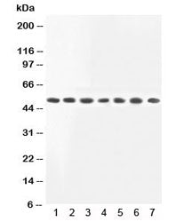 Western blot testing of MEK2 antibody and Lane 1: rat skeletal muscle; 2: rat kidney; and human samples 3: HeLa; 4: COLO320; 5: PC12; 6: Jurkat; 7: HT1080 lysate. Observed molecular weight ~50kDa.