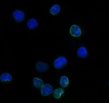Immunofluorescent staining of FFPE mouse RAW264.7 cells with Il2r alpha antibody (green) and DAPI nuclear stain (blue). HIER: steam section in pH6 citrate buffer for 20 min.