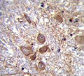 IHC testing of FFPE human brain tissue with SPECC1L antibody. HIER: steam section in pH6 citrate buffer for 20 min and allow to cool prior to staining.