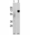 Western blot analysis of CAMKK2 antibody and 293 cell lysate either nontransfected (c) or transiently transfected with the CAMKK2 gene (2). Predicted molecular weight 60-65 kDa.