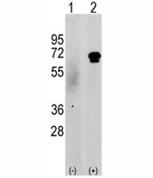 Western blot analysis of CAMKK2 antibody and 293 cell lysate either nontransfected (c) or transiently transfected with the CAMKK2 gene (2). Predicted molecular weight 60-65 kDa.