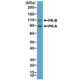 Western blot testing of human T-47D cell lysate with recombinant PR antibody at 1:2000 dilution. Expected molecular weight: 82-94 kDa (PR-A) and 99-120 kDa (PR-B).