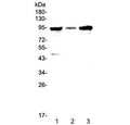 Western blot testing of human 1) HepG2, 2) PANC-1 and 3) SGC-7901 cell lysate with GNS antibody at 0.5ug/ml. Predicted molecular weight ~62 kDa, can be observed at ~94 kDa.