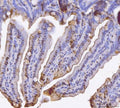IHC staining of FFPE mouse colon tissue with Bid antibody. HIER: boil tissue sections in pH8 EDTA for 20 min and allow to cool before testing.
