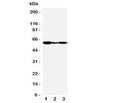 Western blot testing of GPR30 antibody and Lane 1: human COLO320; 2: human MCF-7; 3: monkey COS7 cell lysate. Expected molecular weight: 40-60 kDa depending on glycosylation level.