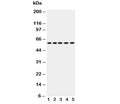 Western blot testing of Occludin antibody and Lane 1: SW620; 2: COLO320; 3: A549; 4: 293T; 5: U87. Predicted molecular weight ~59 kDa.