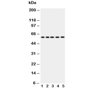 Western blot testing of Occludin antibody and Lane 1: SW620; 2: COLO320; 3: A549; 4: 293T; 5: U87. Predicted molecular weight ~59 kDa.