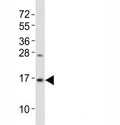 Western blot testing of LC3B antibody at 1:2000 dilution + mouse brain lysate; Predicted band size : 15 kDa.