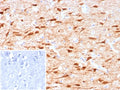 IHC staining of FFPE human brain tissue with NECAB1 antibody (clone NECAB1/7677). Inset: PBS used in place of primary Ab (secondary Ab negative control). HIER: boil tissue sections in pH 9 10mM Tris with 1mM EDTA for 20 min and allow to cool before testing.