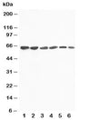 Western blot testing of FMO4 antibody and Lane 1: rat liver; 2: mouse liver; 3: human SMMC-7721; 4: (m) HEPA; 5: (h) A431; 6: (h) MCF-7 cell lysate. Predicted size ~63KD