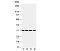 Western blot testing of SOD3 antibody and Lane 1: human placenta; 2: A549; 3: MM231; 4: MCF-7 cell lysate. Predicted molecular weight: 26~32 kDa.