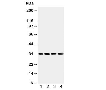 Western blot testing of SOD3 antibody and Lane 1: human placenta; 2: A549; 3: MM231; 4: MCF-7 cell lysate. Predicted molecular weight: 26~32 kDa.