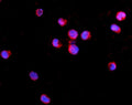Immunofluorescent staining of FFPE human K562 cells with IL2RG antibody (red) and DAPI nuclear stain (blue). HIER: steam section in pH6 citrate buffer for 20 min.