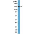 Western blot testing of human Daudi cell lysate with recombinant CD21 antibody at 1:400 dilution. Predicted molecular weight ~113 kDa but may be observed at higher molecular weights due to glycosylation.