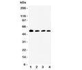 Western blot testing of Antithrombin III antibody and Lane 1: rat testis; 2: SMMC-7721; 3: Jurkat; 4: Raji cell lysate. Expected/observed size ~52KD