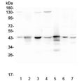 Western blot testing of human 1) HeLa, 2) placenta, 3) A549, 4) MCF7, 5) U-937, 6) U-2 OS and 7) Caco-2 lysate with ADA antibody at 0.5ug/ml. Predicted molecular weight ~41 kDa.