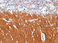 IHC staining of FFPE human brain tissue with Neural cell adhesion molecule L1 antibody (clone L1CAM/13053R). HIER: boil tissue sections in pH 9 10mM Tris with 1mM EDTA for 20 min and allow to cool before testing.