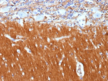 IHC staining of FFPE human brain tissue with Neural cell adhesion molecule L1 antibody (clone L1CAM/13053R). HIER: boil tissue sections in pH 9 10mM Tris with 1mM EDTA for 20 min and allow to cool before testing.