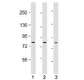 Western blot testing of TLR2 antibody at 1:500: Lane 1) human Ramos, 2) A549 and 3) MDA-MB-231 cell lysate. Predicted molecular weight: 85-90 kDa.