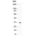 Western blot testing of recombinant mouse IL17 protein (0.5ng/lane) + tag with IL17 antibody at 0.5ug/ml. Predicted molecular weight of native protein: 15-20 kDa (monomer), 30-40 kDa (homodimer), depending on glycosylation level.