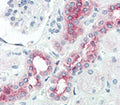 IHC analysis of FFPE human kidney tissue stained with BMPR2 antibody.