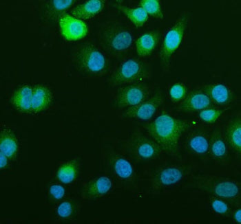 Immunofluorescent staining of SCD using anti-SCD1 antibody (green). SCD1 was detected in an immunocytochemical section of cells. Enzyme antigen retrieval was performed using IHC enzyme antigen retrieval reagent for 15 mins. The cells were blocked with 10% goat serum. And then incubated with 5 ug/ml rabbit anti-SCD1 antibody overnight at 4oC. DyLight 488 Conjugated Goat Anti-Rabbit IgG was used as secondary antibody at 1:500 dilution and incubated for 30 min at 37oC.