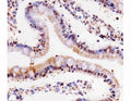 IHC testing of paraffin-embedded rat small intestine using Cdk4 antibody at 1:25.