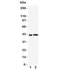 Western blot testing of Leupaxin antibody and Lane 1: rat thymus; 2: human Jurkat cell lysate. Expected/observed size ~43KD