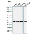 Western blot testing of human A431, 293T and HepG2 cell lysate and mouse NIH 3T3 cell lysate with PCNA antibody. Predicted molecular weight ~29 kDa, routinely observed at 29~36 kDa.